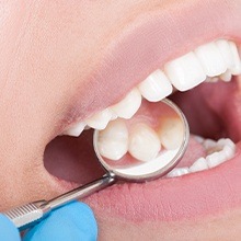 Dentist examining patient's metal free dental restoration